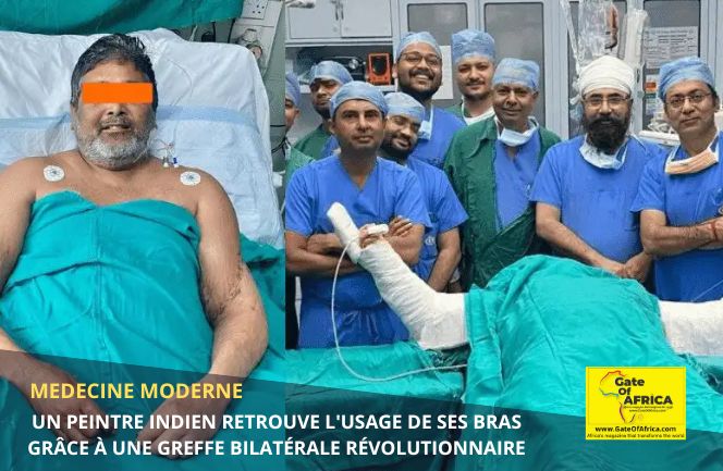 Un peintre indien retrouve l’usage de ses bras grâce à une greffe bilatérale révolutionnaire